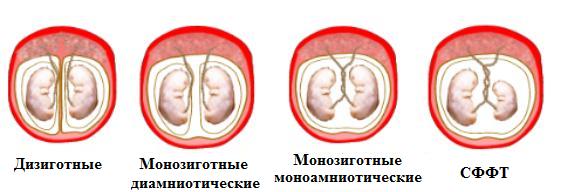 00110 Ультразвуковая диагностика при многоплодной беременности