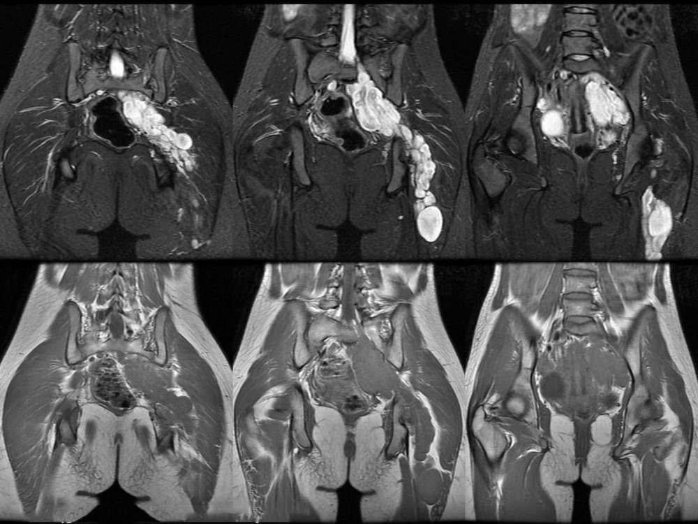 1398016010 snimok tomografii zhenskih organov КТ органов малого таза