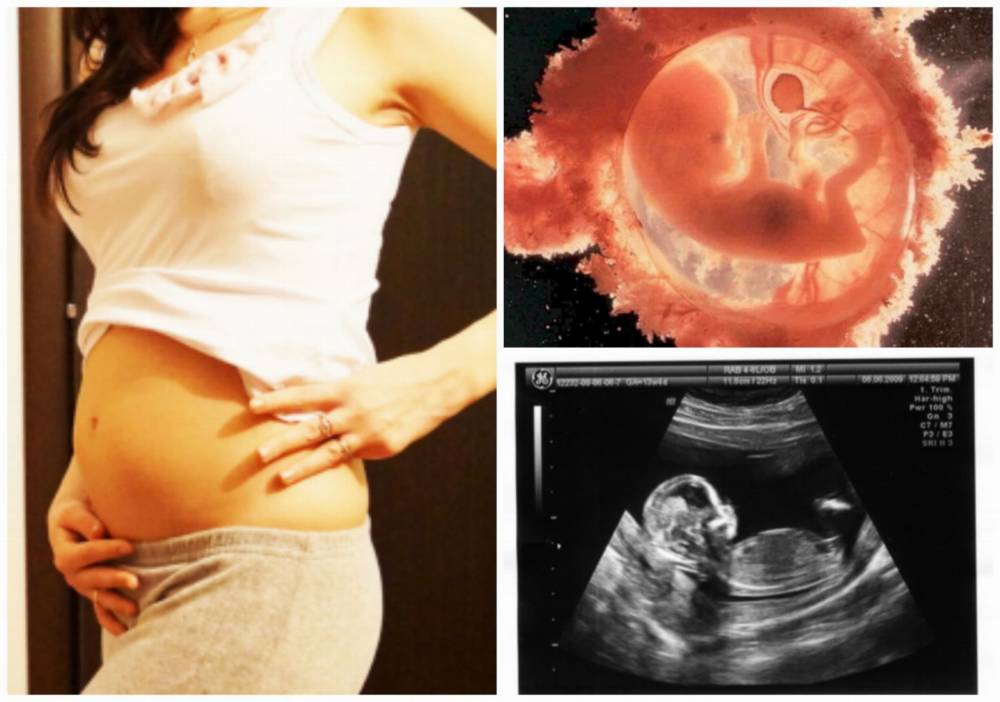 PicMonkey Collage106 Клиническое течение беременности