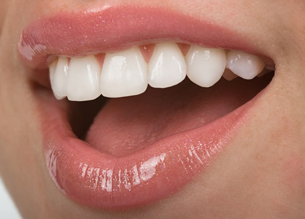 Vinir 1 Принципы профилактики зубных отложений