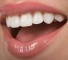 Vinir 1 Принципы профилактики зубных отложений
