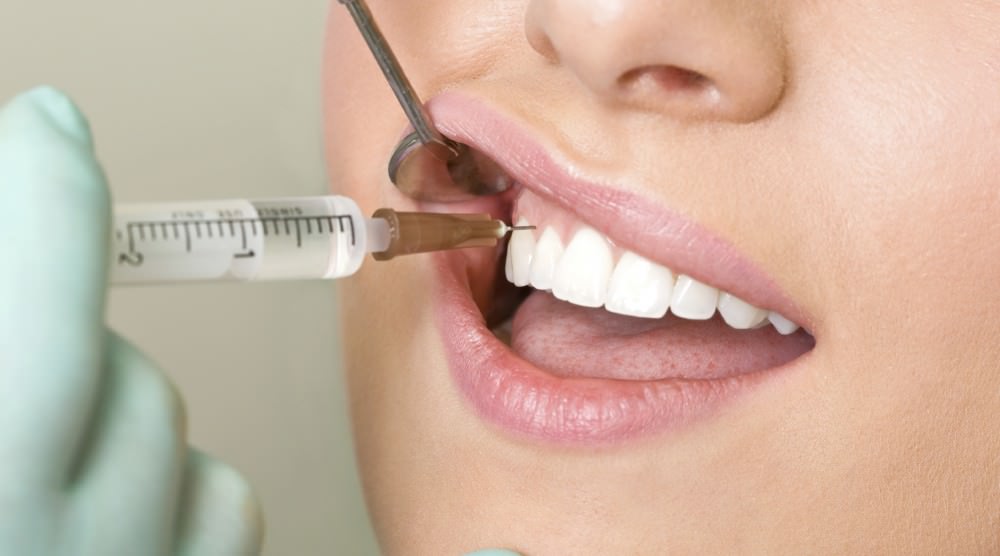 dentalikaarticle Микроорганизмы зубных отложений