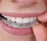 istock 000015965405medium Аномалии расположения зубов и патологические прикусы