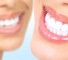 stockfresh id429055 woman teeth sizeM db8003 Влияние зубных отложений на состояние организма
