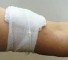 pressure bandage Давящие повязки