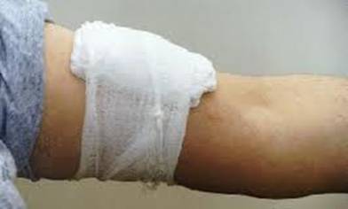 pressure bandage Давящие повязки