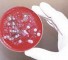 features of anthrax bacilli Особенности сибиреязвенных бацилл