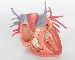 calcification of the coronary arteries Кальцификация коронарных артерий