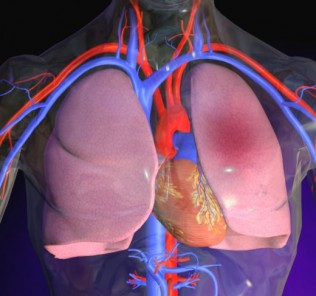 pathological pulmonary blood flow and pulmonary edema Патологический легочный кровоток и отек легких