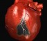 pathophysiology of perioperative cardiac events Патофизиология периоперационных кардиальных событий