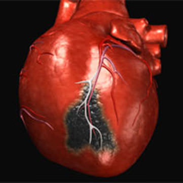 pathophysiology of perioperative cardiac events Патофизиология периоперационных кардиальных событий