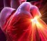 profile risk of peripheral artery disease Профиль риска развития заболевания периферических артерий