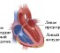 reduction of ventricular Сокращение желудочка