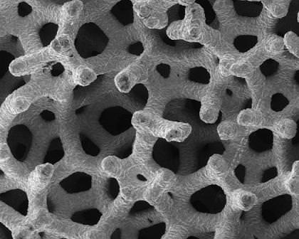stem cells in the bone marrow Стволовые клетки костного мозга