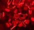 anticoagulant activity of blood in the tumor process Антикоагулянтная активность крови при опухолевом процессе