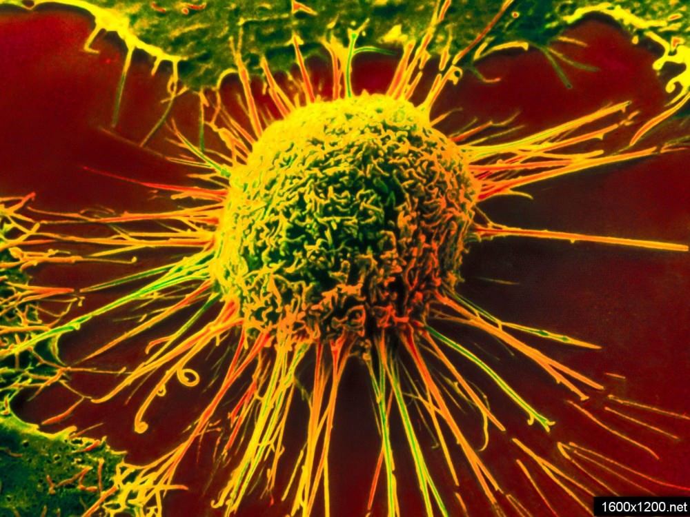 fibrinolytic properties of tumor cells Фибринолитические свойства опухолевых клеток