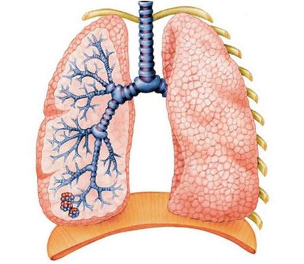 inflammation from the lungs Воспалительные явления со стороны легких