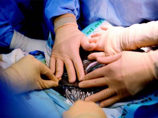 surgery gastrostomy Операции гастростомии