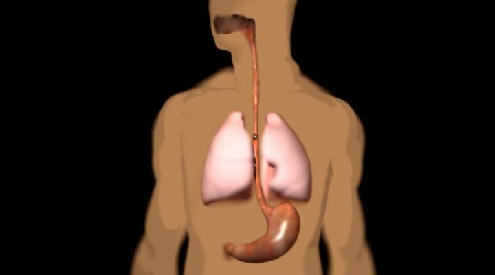 the esophagus into the mediastinum Пищевод в средостении