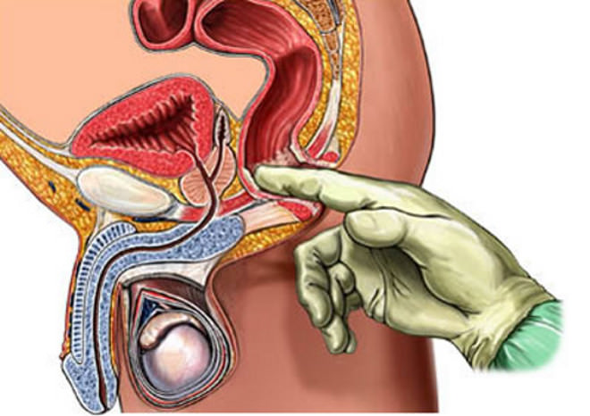 the tissue of the prostate gland Ткань предстательной железы