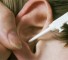 many years of experience treating tinnitus Многолетний опыт лечения шума в ушах