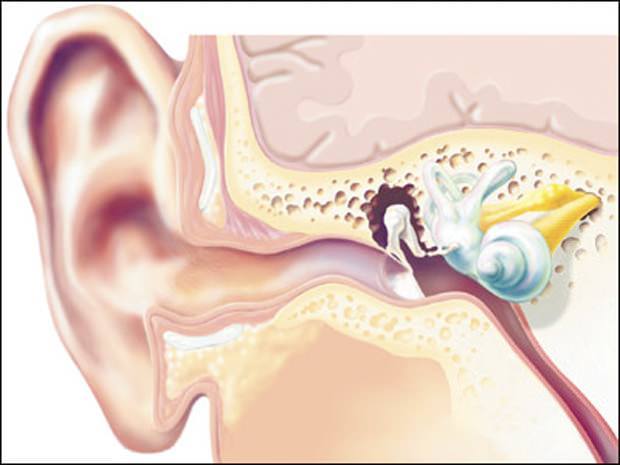 no changes hearing Отсутствие изменения слуха