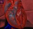 abnormal position of the heart Аномалии положения сердца