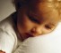 condition annealed children with sepsis Состояние обожженных детей с сепсисом