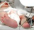 persistent ductus arteriosus in newborns with low weight Открытый артериальный проток у новорожденных с небольшой массой тела