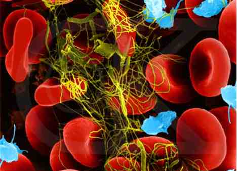phase 3 of the blood coagulation system Фаза 3 системы свертывания крови