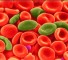 sickle cell anemia Серповидно-клеточная анемия