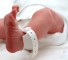 thrombocytopenia in newborns Тромбоцитопения новорожденных