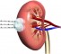 tumors of the kidney Опухоли почек