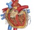 ventricular septal defect combined with insufficiency of aortic valves Дефект межжелудочковой перегородки в сочетании с недостаточностью клапанов аорты