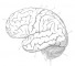violations of differentiation and growth of the cerebral hemispheres Нарушения дифференцировки и роста полушарий головного мозга