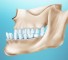 anterior displacement of the mandible Мезиальное смещение нижней челюсти