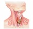 the increase in production of thyroid hormone Увеличение продукции гормона щитовидной железы