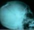 x ray examination of the skull in adults Рентгенологическое исследование черепа у взрослых