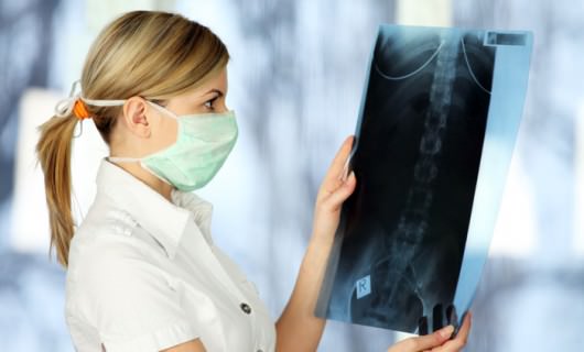 periapical radiography ribs Прицельная рентгенография ребер