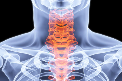 radiography of the cervical spine Рентгенография шейного отдела позвоночника
