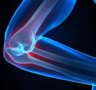radiography of the elbow joint Рентгенография локтевого сустава