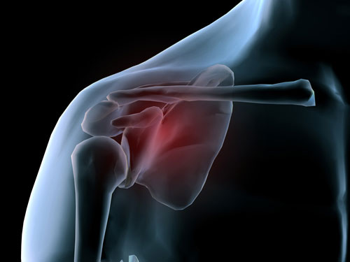 radiography of the shoulder bone Рентгенография лопаточной кости