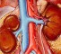 kidney failure Недостаточность почек