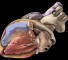 arrhythmogenic cardiomyopathy of the right ventricle Аритмогенная кардиомиопатия правого желудочка