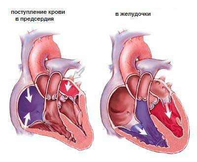 systolic pressure in the pulmonary artery Систолическое давление в легочной артерии