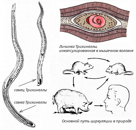 parasitic-worms-worms-trichinella-2