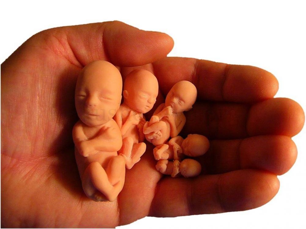 abortion Аборт