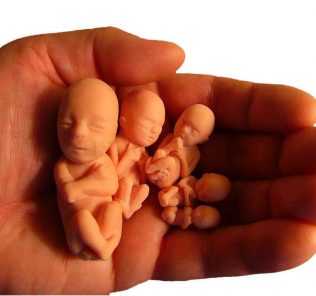abortion Аборт