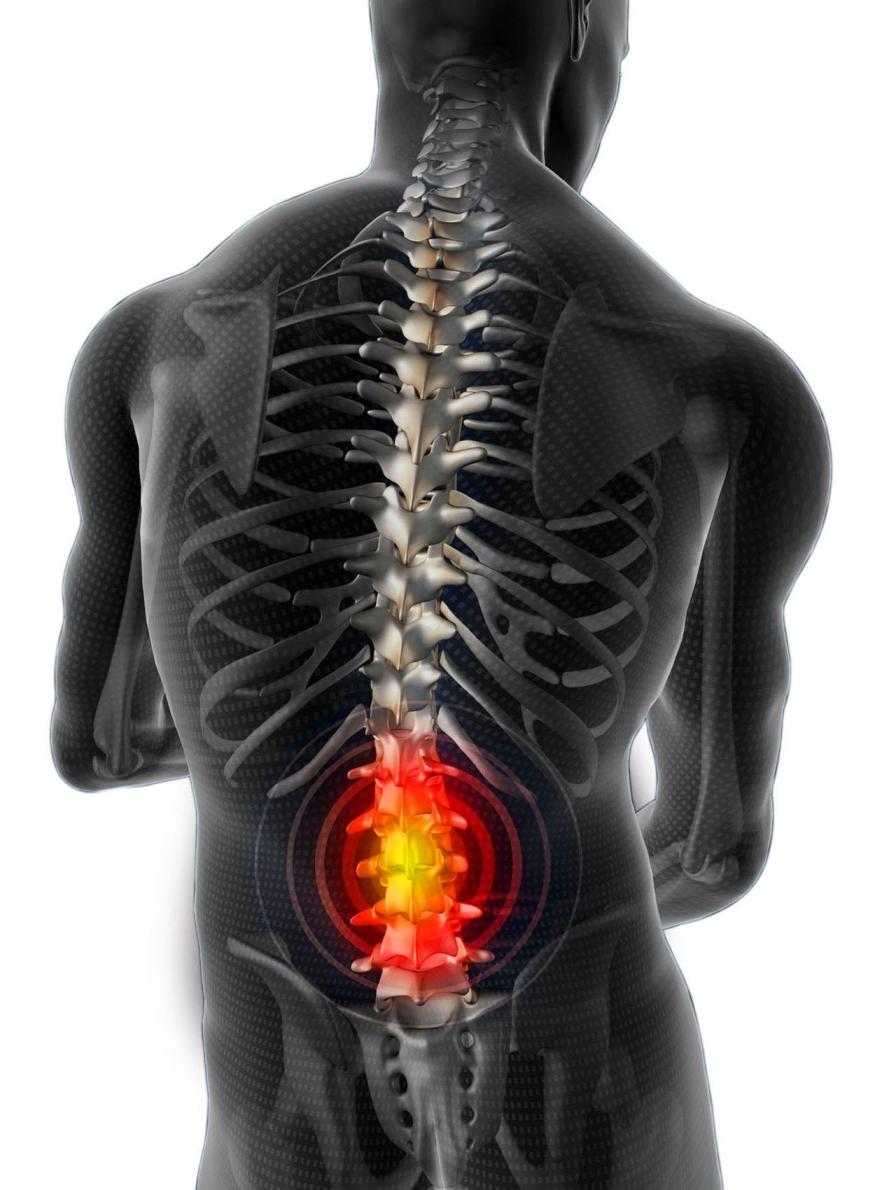 acute pain in the back and inflammation 1 Острая боль в спине: сдавление нерва