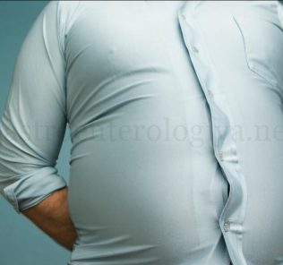 bloatingabdominal Вздутие после еды: боли и газы, причины и лечение